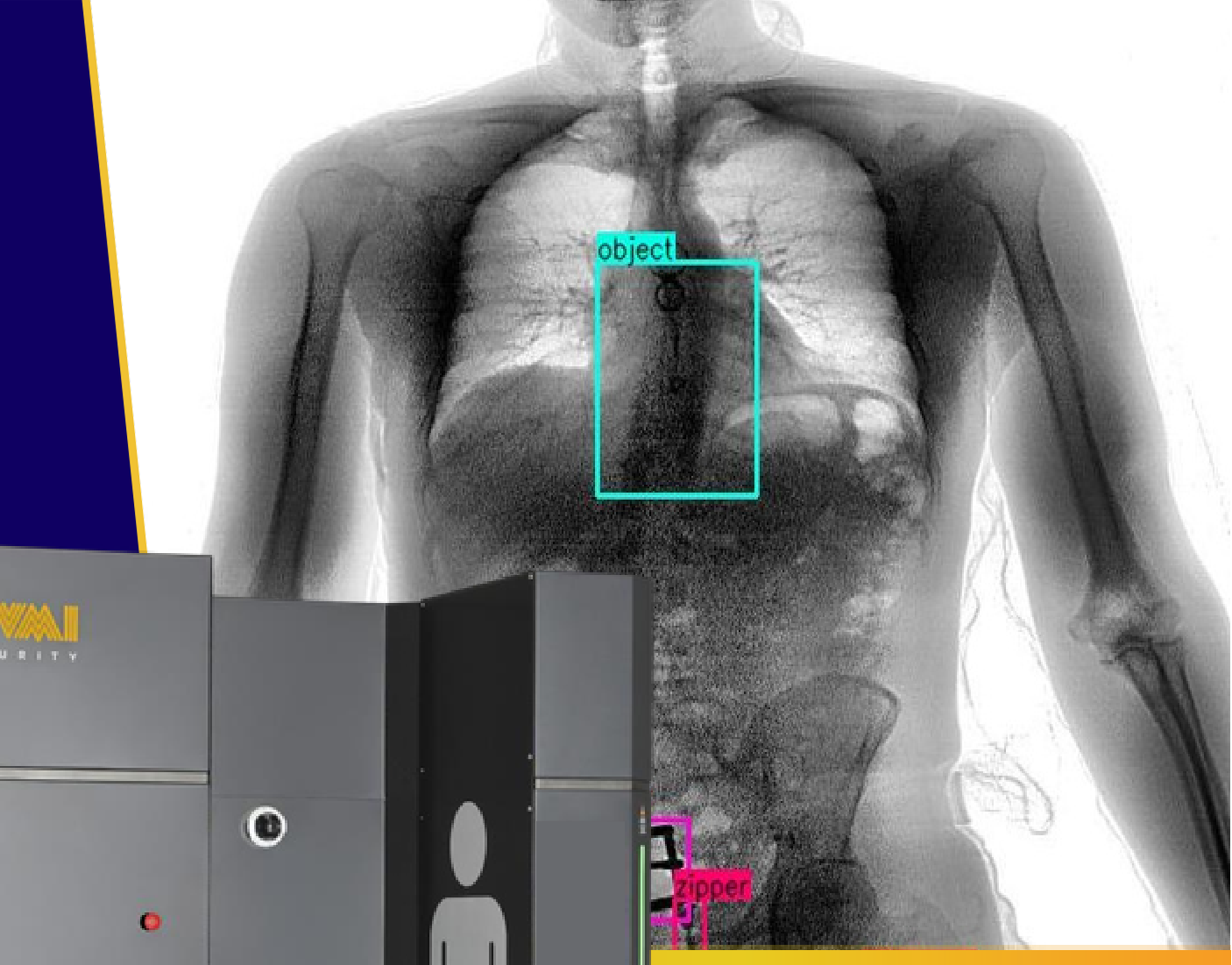 Spectrum Vision X-ray body scan image revealing concealed contraband under clothing
